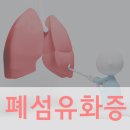 부천 폐섬유화증의 주요 증상 이미지