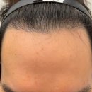 부산 맘모스헤어라인의원 이미지