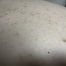 천연화장품&비누 | 태양솝 아토피 여드름 모낭충비누 천연비누 사용후기