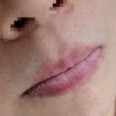 두피에서네일까지 | 잠들면서 받은 입술관리,두피에서네일까지 솔직담백후기