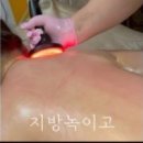 바이폴라