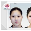 라인페이스치과의원 네이버블로그