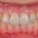 크리스탈치과기공소 이미지