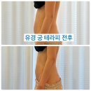 엘가네 | 안양피부관리 엘가비에스테틱에서 특별한 산후관리 받은 후기