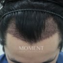 모먼트의원 이미지