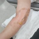 시원외과의원 | 광주화상전문병원 시원외과 후기｜시원외과 내원부터 진단까지 기록(1)