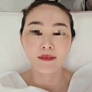 라셀 | 양산 사송피부관리 곽민정스킨앤바디 TLP더라셀 후기