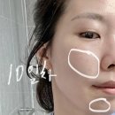 충주피부관리 잡티제거 지율뷰티 후기 쥐젖 비립종제거