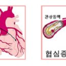 가슴흉통 가슴통증 원인에 대해 알아봐요 이미지