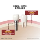 석플란트치과병원 이미지