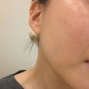 안청남로-2 | 진해피부관리 혜리온에스테틱 장벽관리 후기