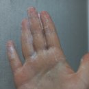 봉글봉글 이미지