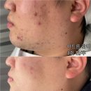 솜 에스테틱 이미지