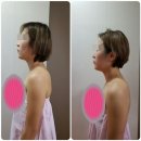 (송파동피부관리) G연정에스테틱에서 CS2스팀샤워입체윤곽관리 꾸준히 받은 후기