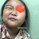 우태하한승경피부과 네이버블로그