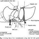 두 개의 이식편을 이용한 성인대 성인 생체부분 간이식 이미지