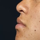 나인피부과의원 이미지