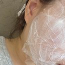 부평한의원 | 부평 편평사마귀 성지 부평역 도보 1분 거리 끗한의원 부평 후기