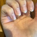 엔비네일 - 중구 | 상한손톱 관리 OPI 네일엔비 손톱영양제 후기 전후사진