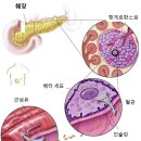 인슈린 저항성이란 무엇인가? 이미지