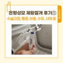 은평성모의료 주식회사 | 은평성모 제왕절개 4박 5일 상세후기 ① : 수술과정 및 통증, 비용, 수유(젖몸살), 샤워 등