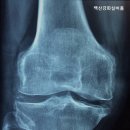 백산강화실버홈 네이버블로그