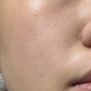 부용초등학교 | [라씨엘르 진정크림·탄력크림·바쿠치올크림] 식물유래 슬로우에이징 케어 진짜 후기 말아왔슴둥!🌿