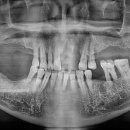 치아룸 치과기공소 이미지