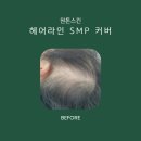 스타헤어라인 네이버블로그