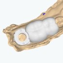 플래닝 치과기공소 이미지