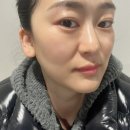 듀띠끄에스테틱 | 만성동피부관리 전주 물톡스 [듀띠끄에스테틱] 이용후기