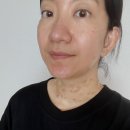 유명한의원 | 서면 편평사마귀 제거 잘하기로 유명한 한의원 2회차 내돈내산 솔직후기!!