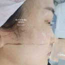 한솔약업사 | 대구 스킨플래닝 한번 받으면 중독되는 자민뷰티