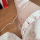 _전원말길6_표찰 | 아기낳는 날(1) 미르피아 제왕절개 1일~3일