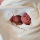 아주대학병원 | 신생아발가락휨 아기 컬리토 아주대학병원 소아 정형외과 진료후기 | 신생아발가락 휘어짐 | 컬리토...