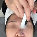 대실역남로 | 대구 다사 피부관리, 대실역 LDM 물방울 리프팅 후기 [오늘은스킨&amp;테라피]