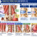 아침에 허리가 뻣뻣하고 아프다면? 하루 7분 허리통증 완화 스트레칭 이미지
