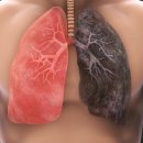 증평요양병원 이미지