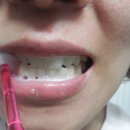 시그마덴탈 이미지