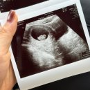 그레이스병원 | [임신일기] 10주차 계류유산 그레이스병원 소파술 후기