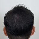 대구SMP