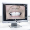 달라스연합치과의원 | 덜덜 떨던 내 이빨의 구원투수 등판! 전주 365 치과 솔직 후기