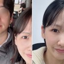 큐티1 | 연신내 귀필러 요정귀 큐티필 대만족 후기