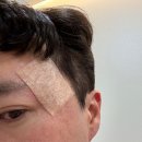 로담한의원(가산금천점) | 가산디지털단지 한의원에서 여드름흉터 치료 받기 1탄!!