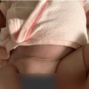 박진영병원 | 대구 경북대병원::서혜부 탈장 수술 (박진영교수님)