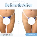 청담코지의원 이미지