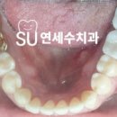 제일치과기공소 이미지