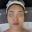 FORME:포미 | 광주 풍암동 윤곽관리 꼼꼼한케어 추천후기 포미뷰티