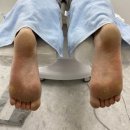 레푸스 태릉입구역 | 공릉동각질제거 레푸스태릉입구역점 무좀발톱관리