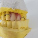 다윗치과기공소 이미지